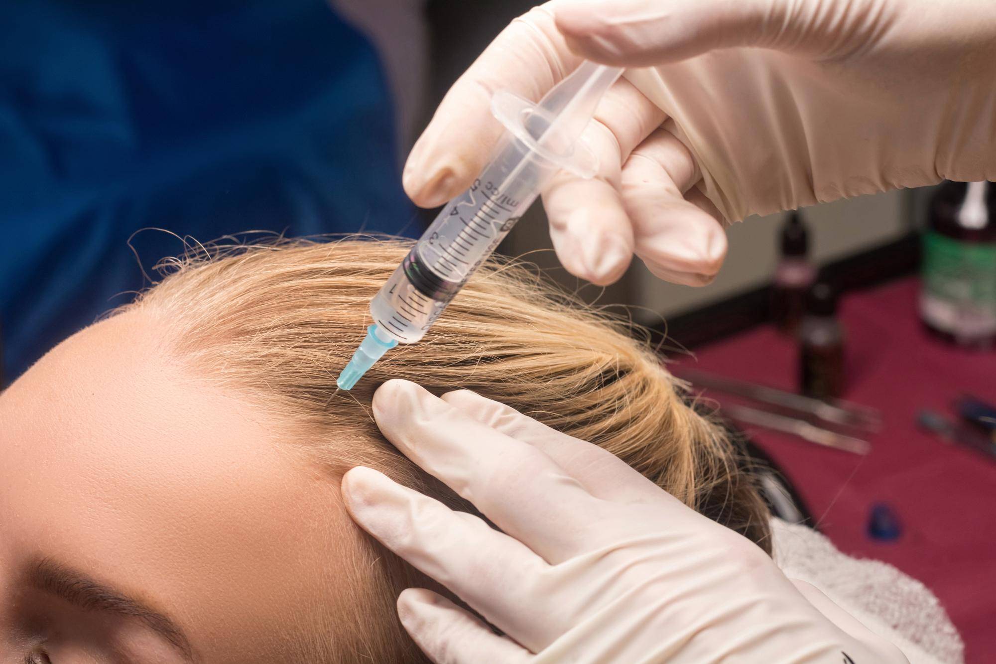 Botox na włosy jak wygląda zabieg w salonie fryzjerskim?